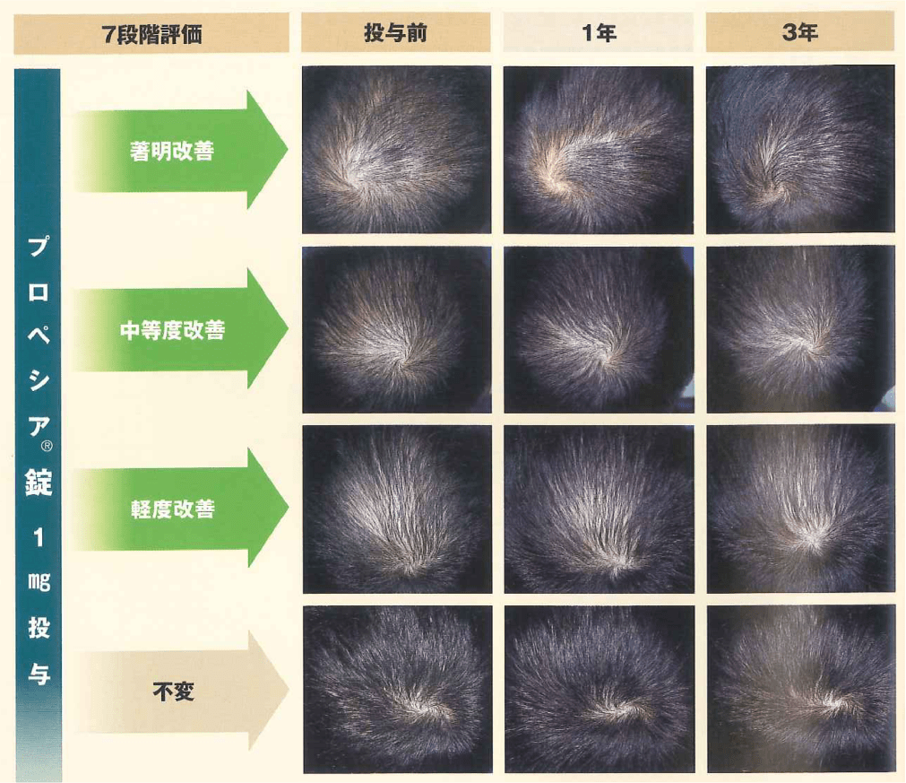 プロペシア®錠1mg 3年間投与の図